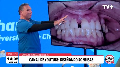 Somos un Plato | 04 de Febrero de 2025