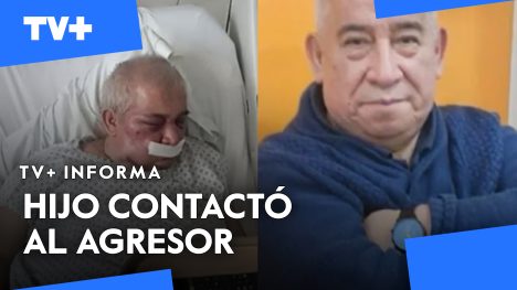 Se confirma que conserje agredido perdió el 70% de la visión