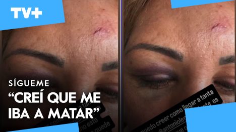 Exchica Mekano sufrió brutal agresión