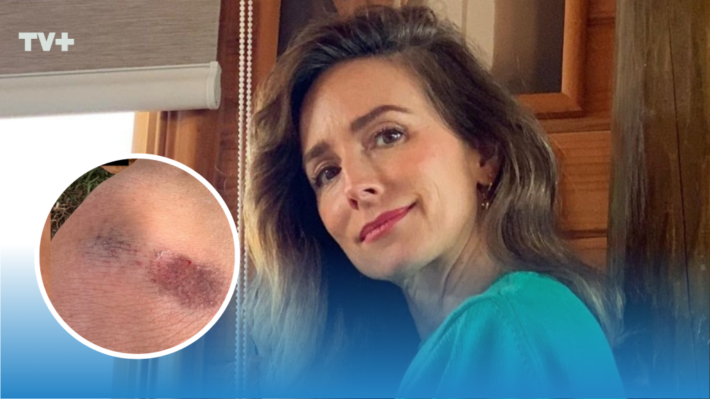 María José Prieto preocupa a sus seguidores tras sufrir accidente de tránsito