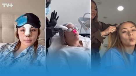 "En recuperación": Skar Labra impacta tras mostrar su nuevo rostro